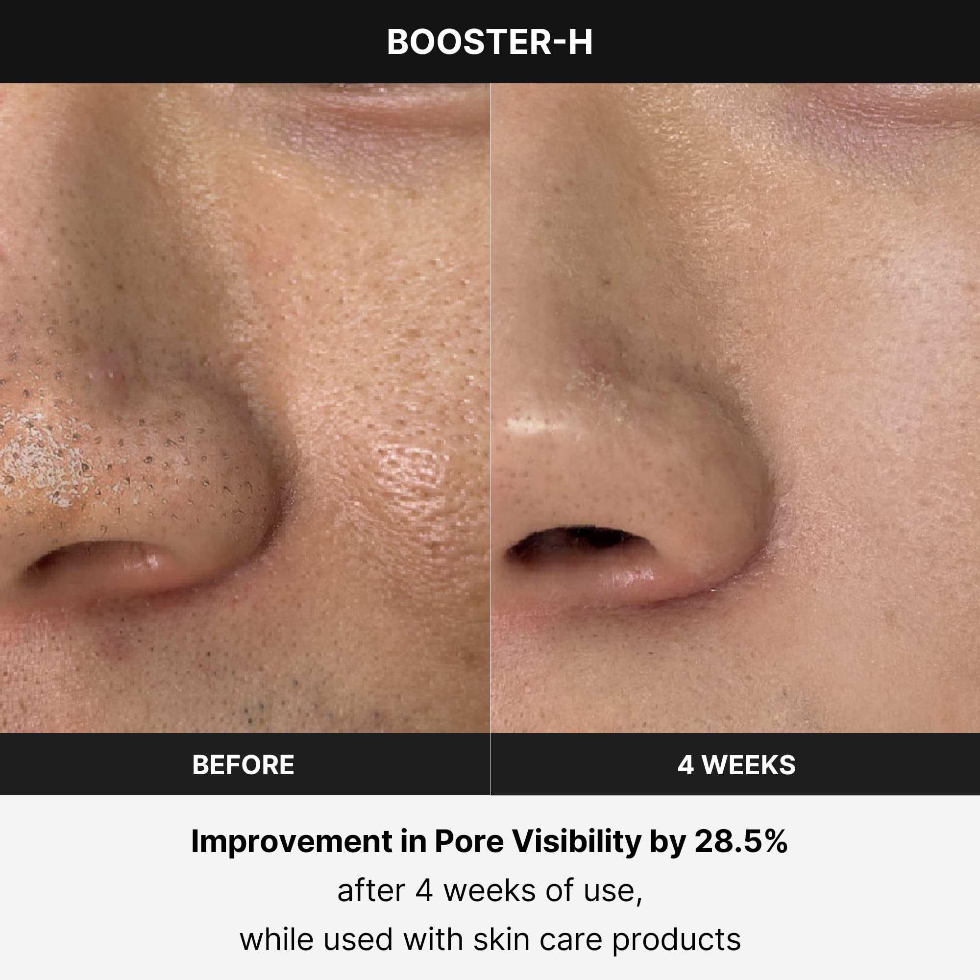 AGE-R Booster-H – Break The Basic