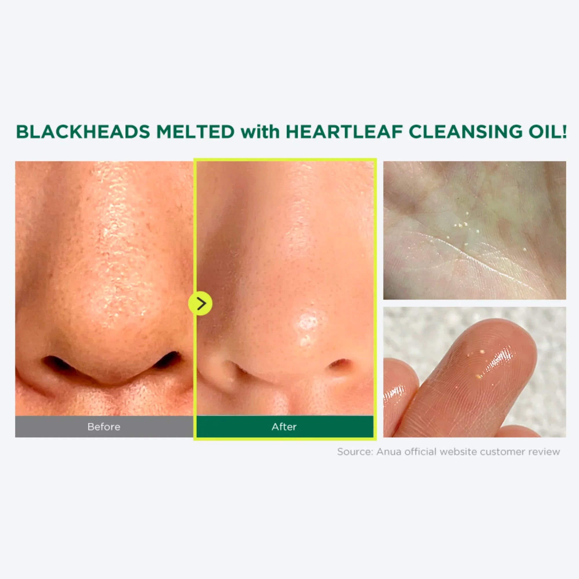 Heartleaf Pore Control Cleansing Oil - Expert Reviews on Blackhead Banishing Properties