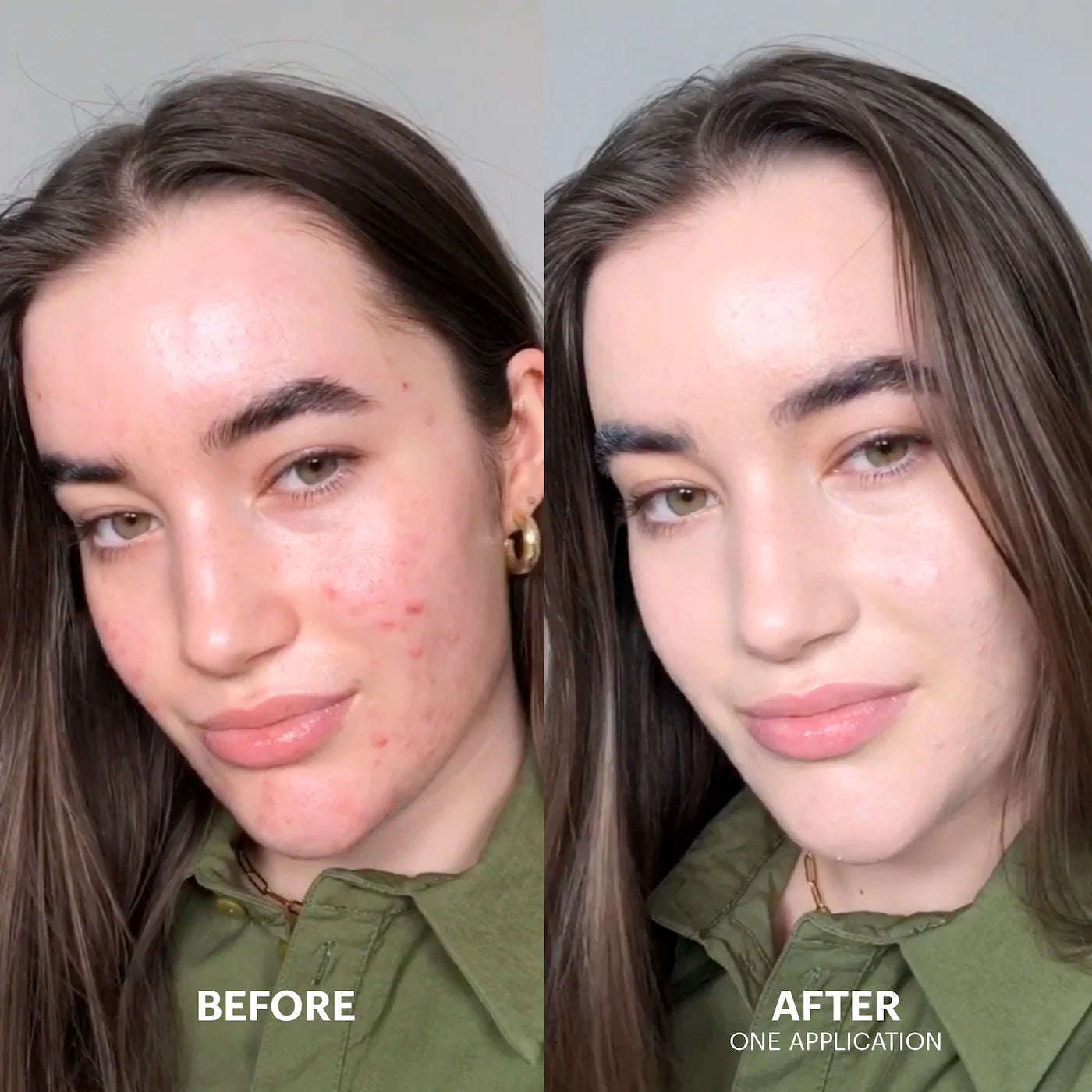 Vegan Cicapair Tiger Grass Color Correcting Treatment for hyperpigmentation