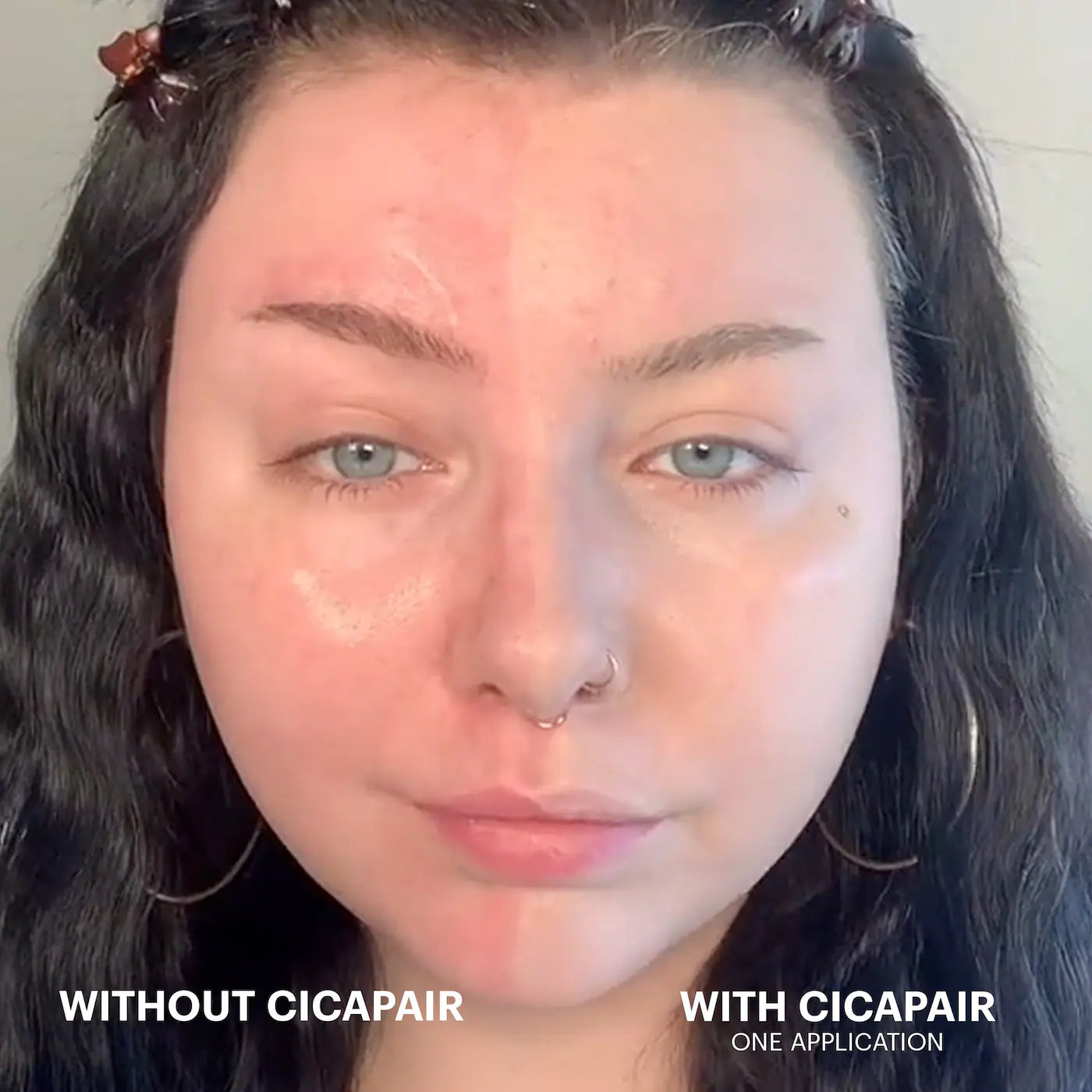 Best cream for reducing redness and blemishes Cicapair review
